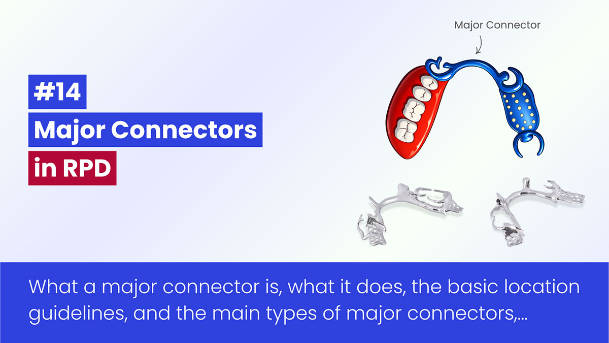 Mandibular Major Connectors In RPD: Types, Functions, And Design Basics