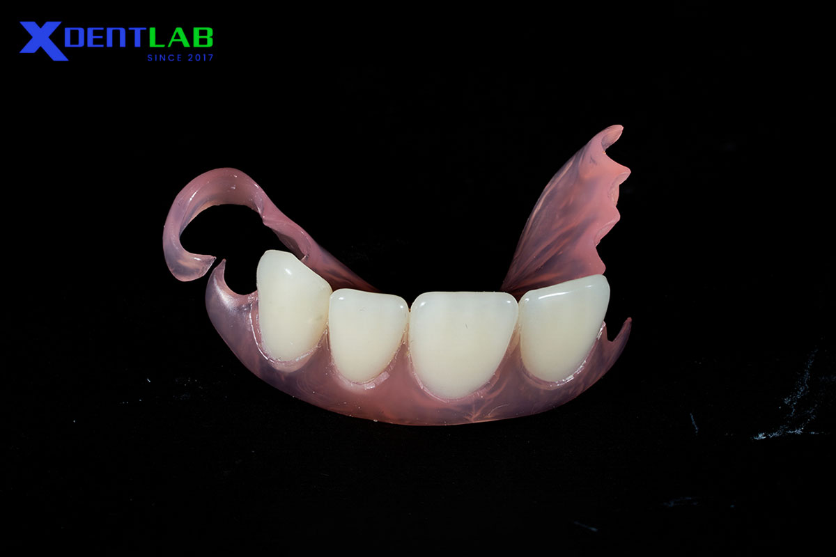 Ứng dụng của polyamide trong nha khoa
