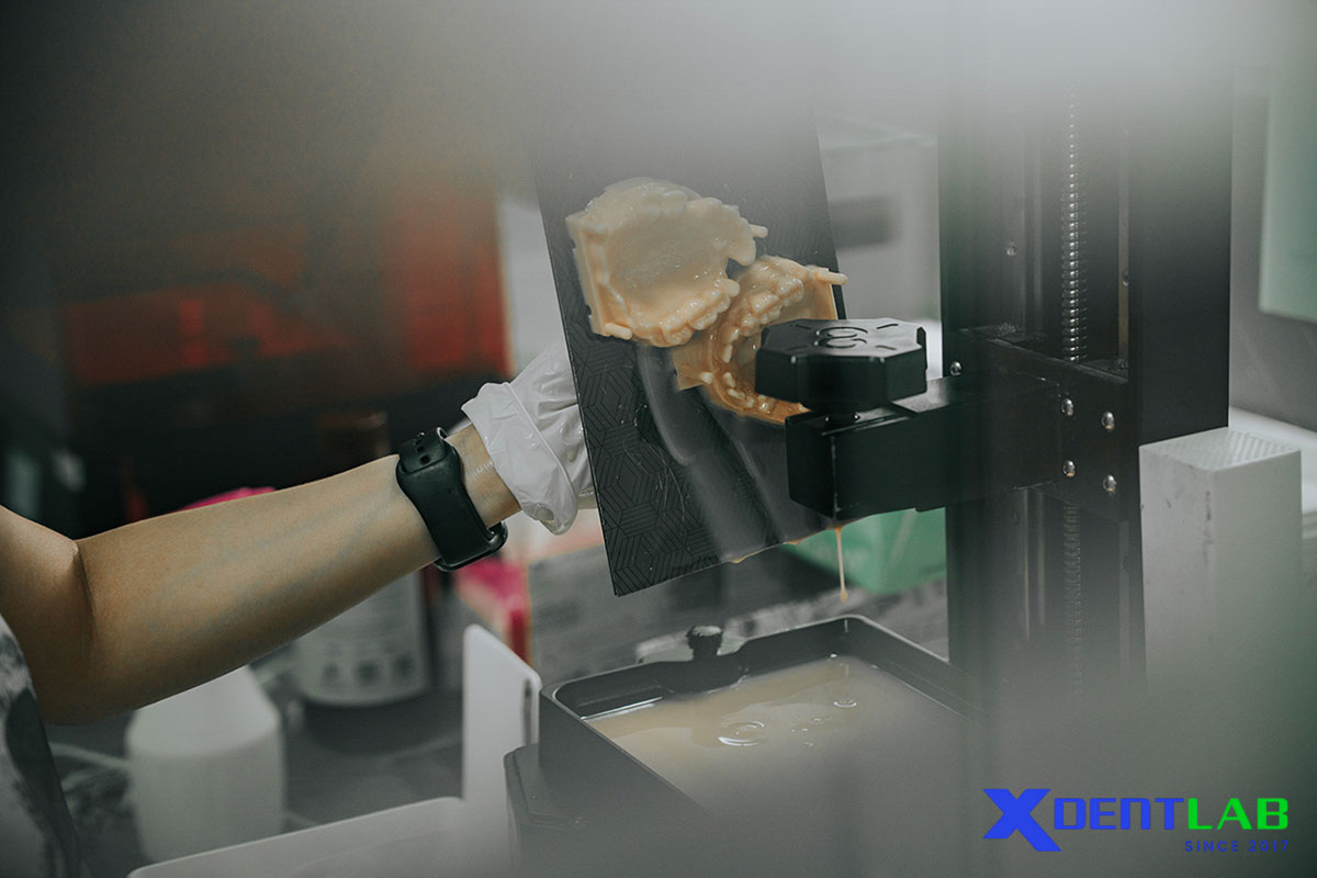 Digital Dentistry and Additive Manufacturing