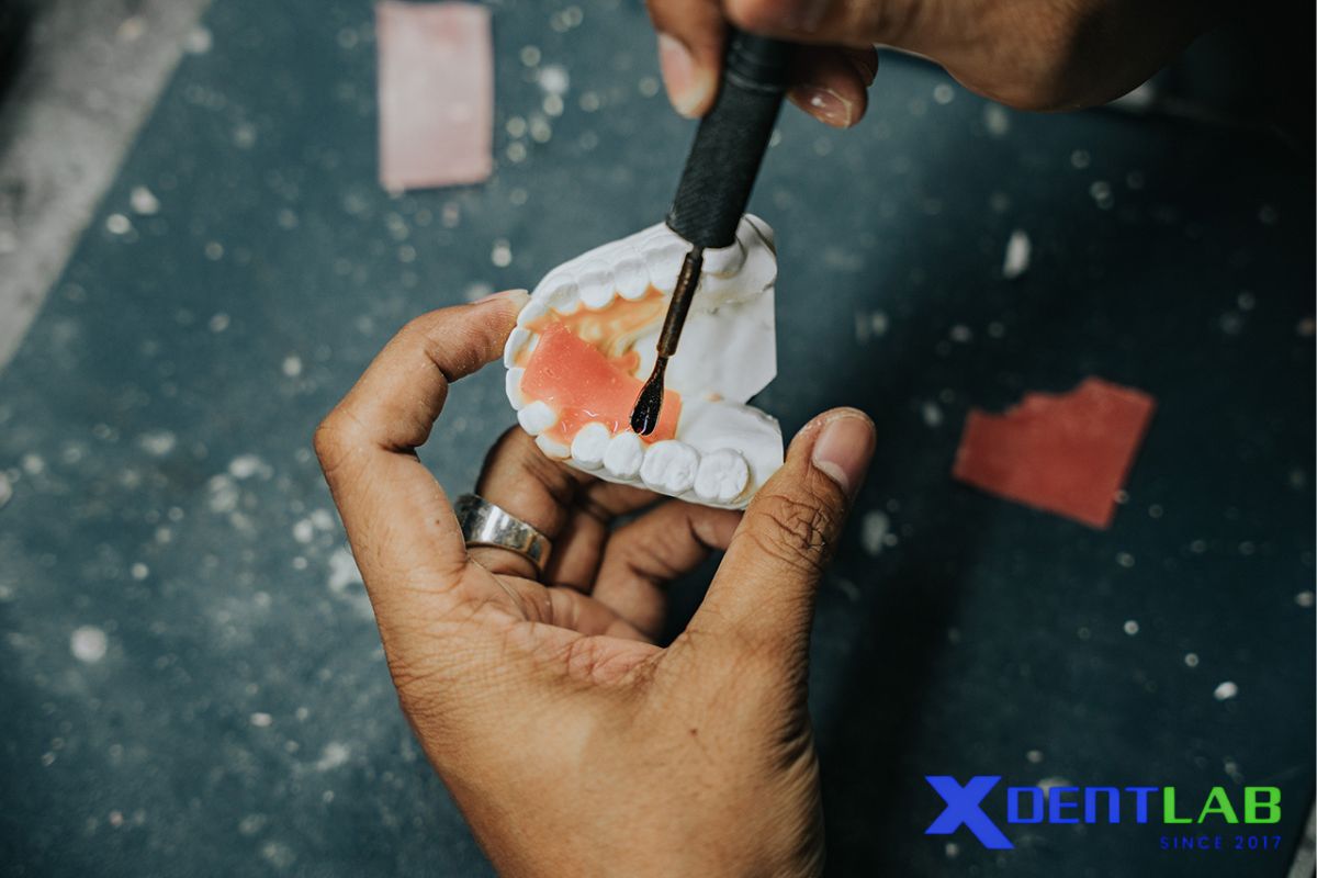 Why Silicone Polymers Matter for Dental Labs and Outsourcing Why Silicone Polymers Matter for Dental Labs and Outsourcing