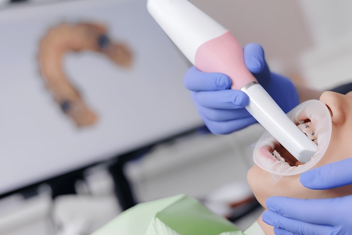 Applications of Vestibular Depth Across Dental Specialties