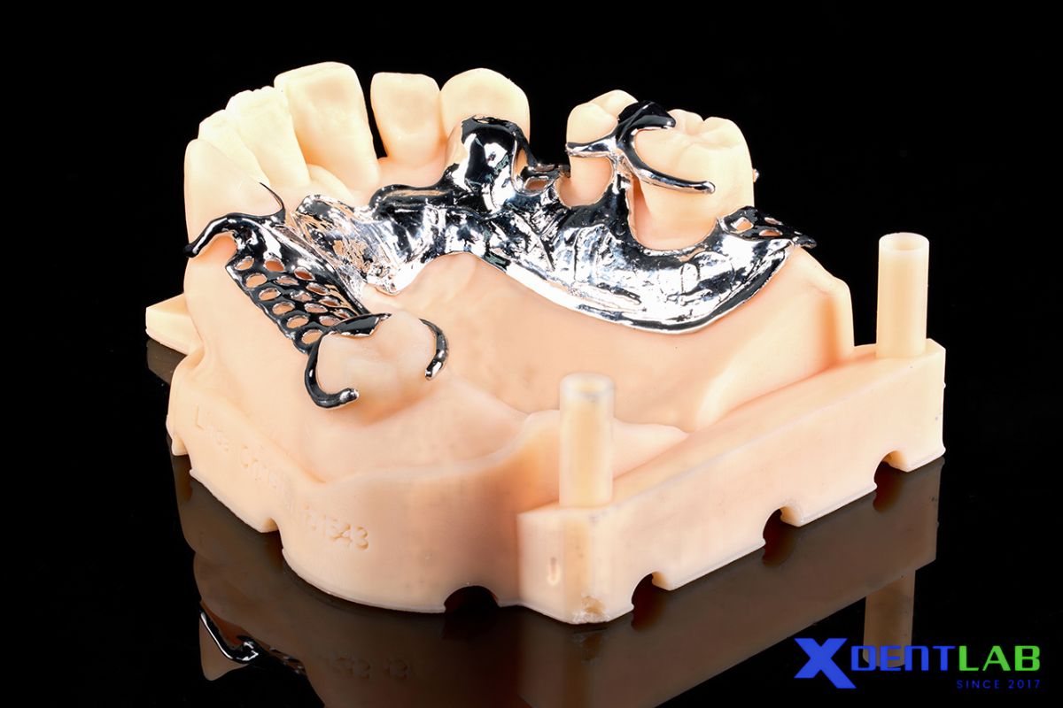 Types of dental frameworks Types of dental frameworks