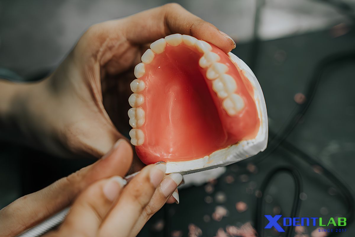 Why digital dentures matter for lab-to-lab outsourcing