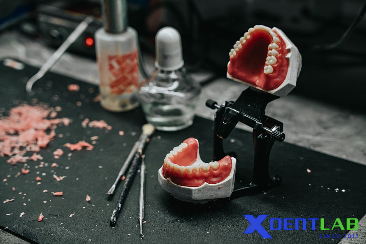 Why Vietnamese dental laboratories are relevant in full-arch cases Why Vietnamese dental laboratories are relevant in full-arch cases