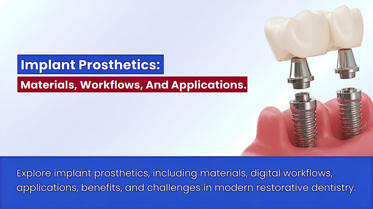 Implant Prosthetics: Materials, Workflows, And Applications
