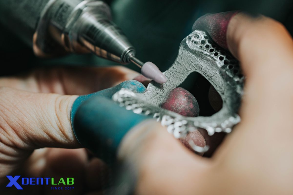Specialized Expertise in Removable Prosthetics Specialized Expertise in Removable Prosthetics