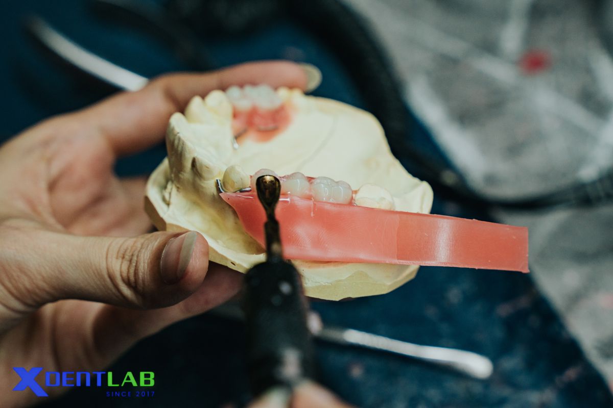 Specialized Expertise in Removable Prosthetics Specialized Expertise in Removable Prosthetics