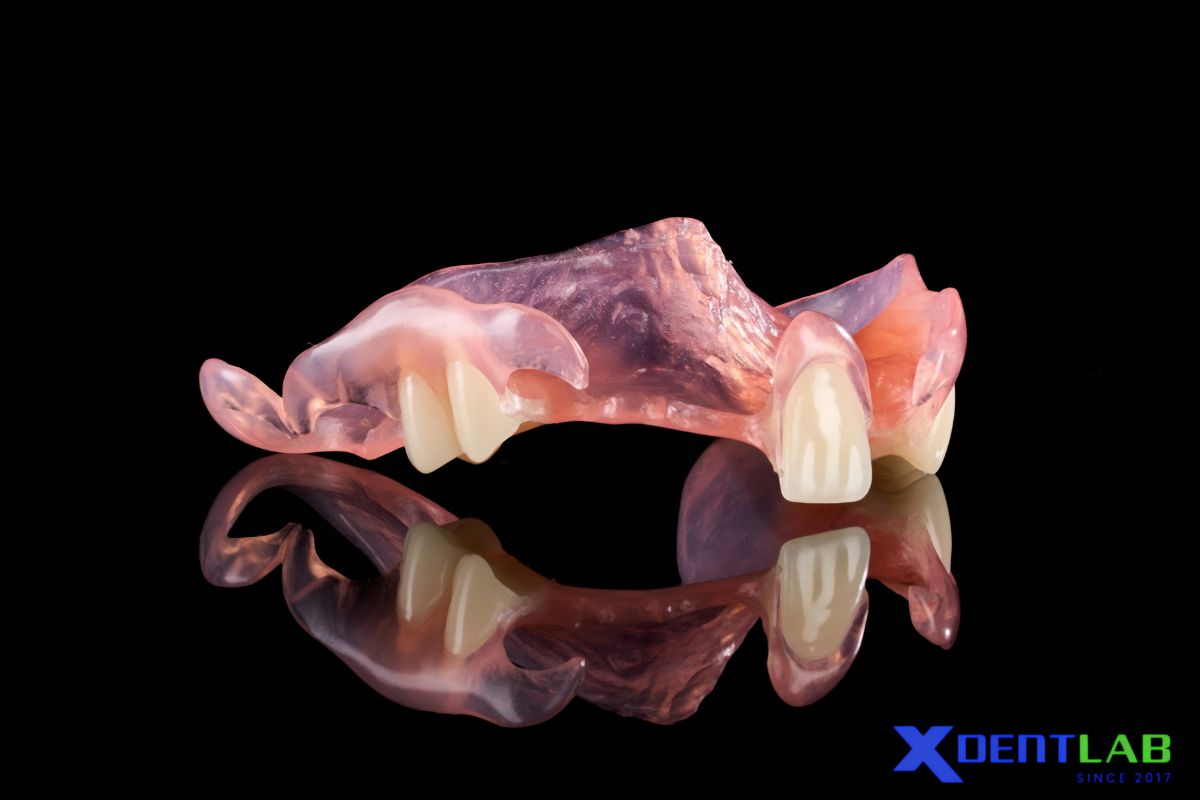 Millable Vs Traditional Injection Molding Workflow For Flexible Partial Denture Millable Vs Traditional Injection Molding Workflow For Flexible Partial Denture