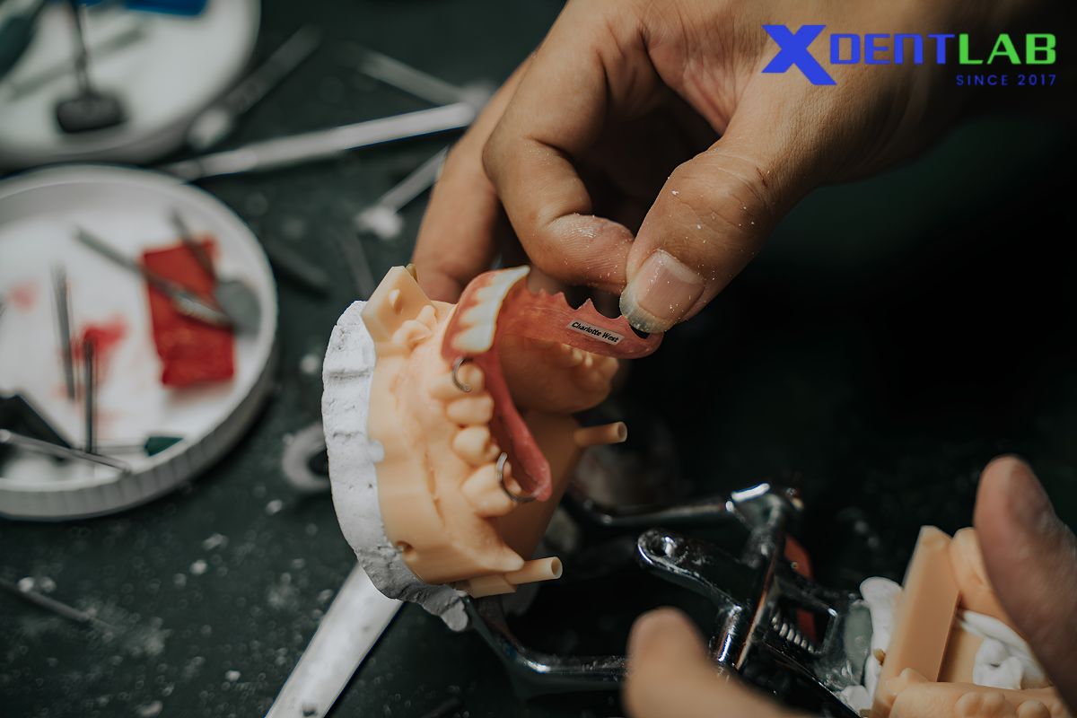 Why polyamides matter for dental labs and outsourcing