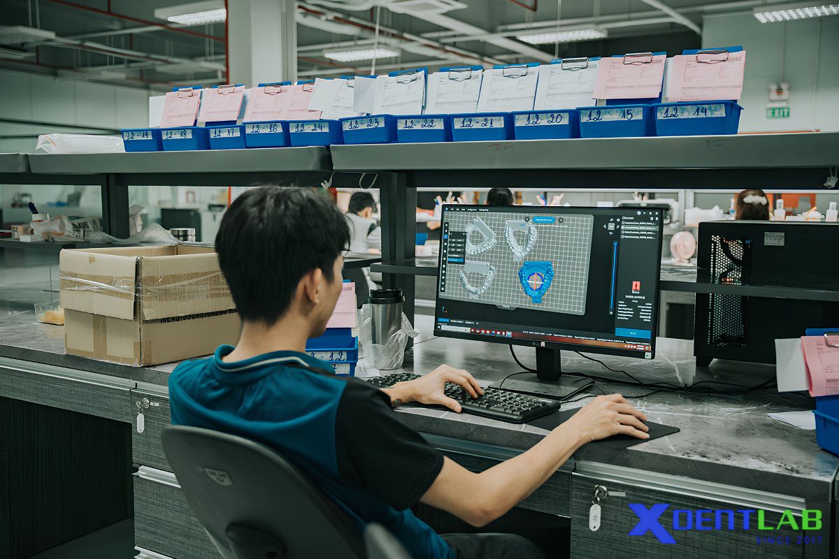 Why digital dentistry matters in dental lab outsourcing