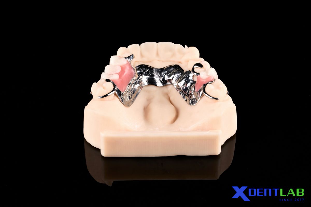 U-Shaped Palatal Connector (D) U-Shaped Palatal Connector (D)