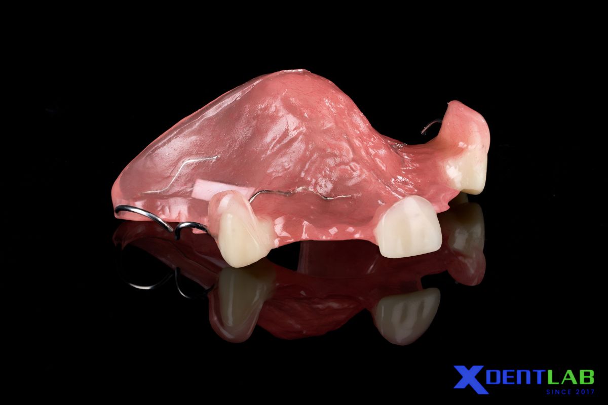 What is a Palatal Plate