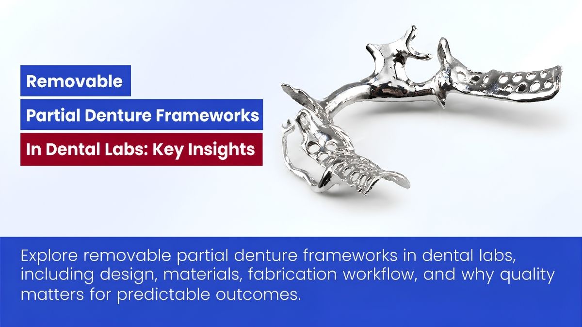Removable Partial Denture Frameworks In Dental Labs: Key Insights