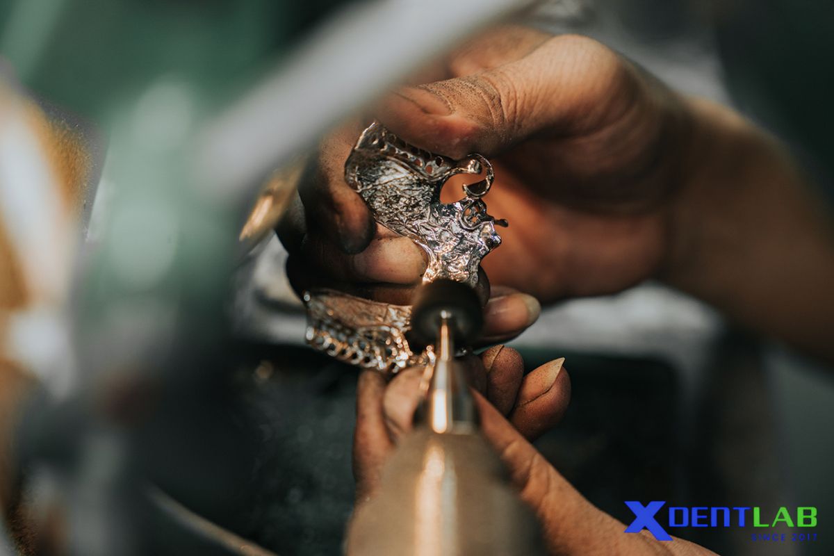 Why removable partial denture framework quality matters in dental lab outsourcing Why removable partial denture framework quality matters in dental lab outsourcing