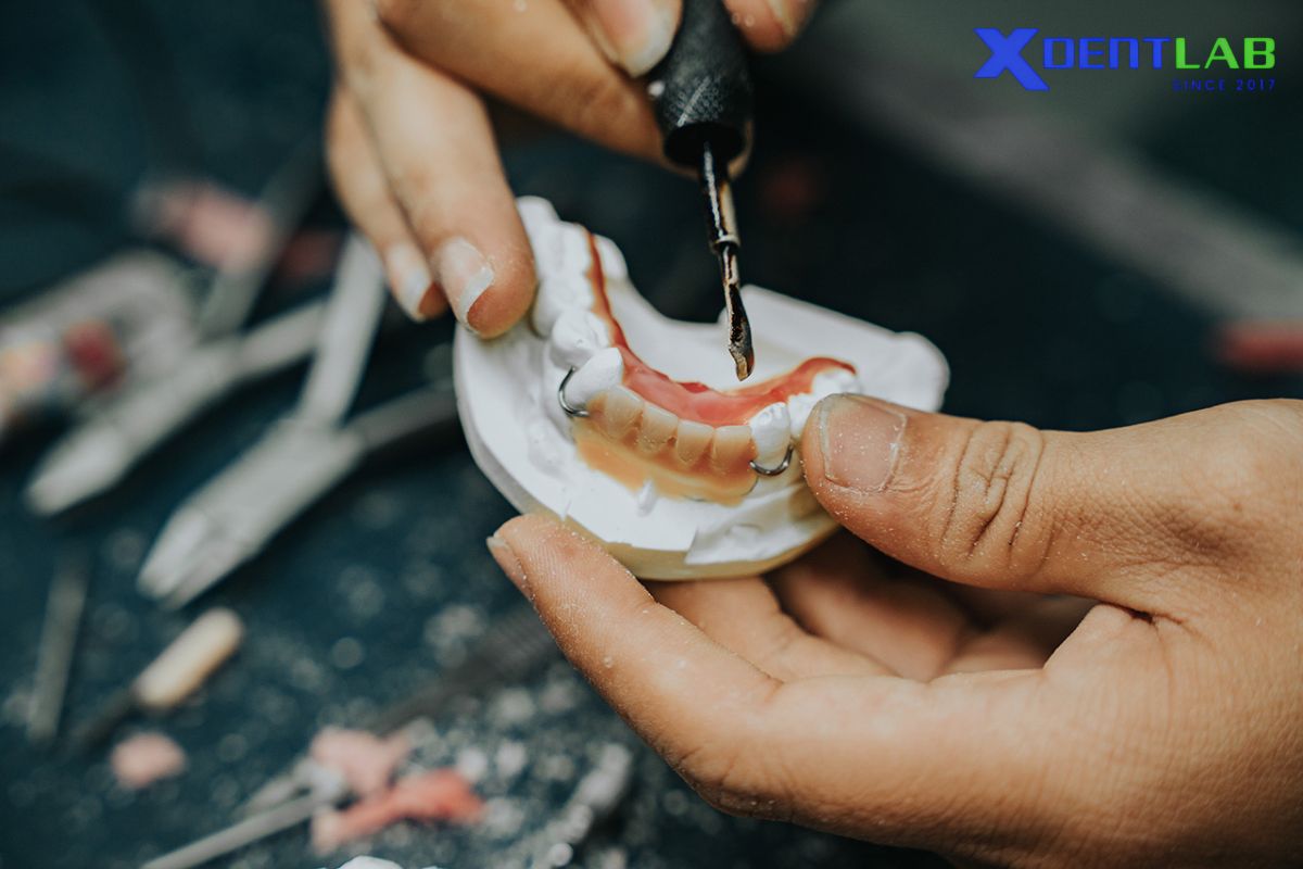Why dental lab partnership matters in restorative dentistry