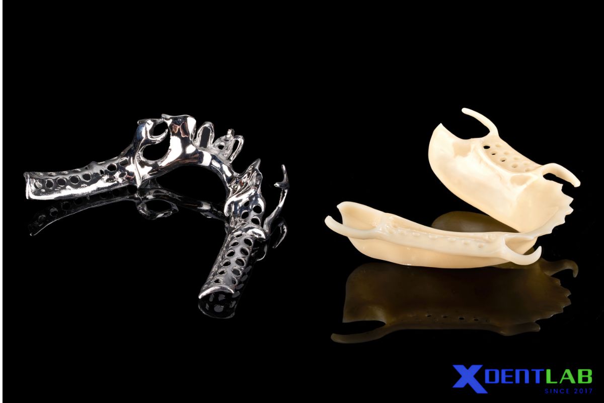 Metal Frame & Metal-Free Frame Dentures