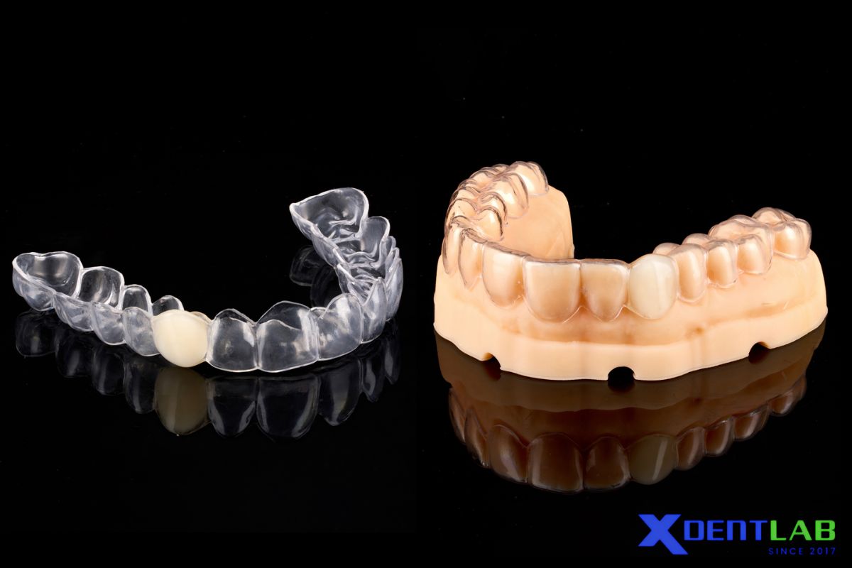 Essix Retainers