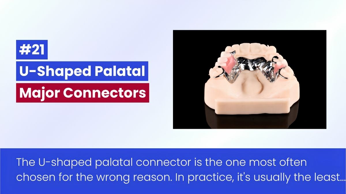 The U-Shaped Palatal Connector In Removable Partial Denture