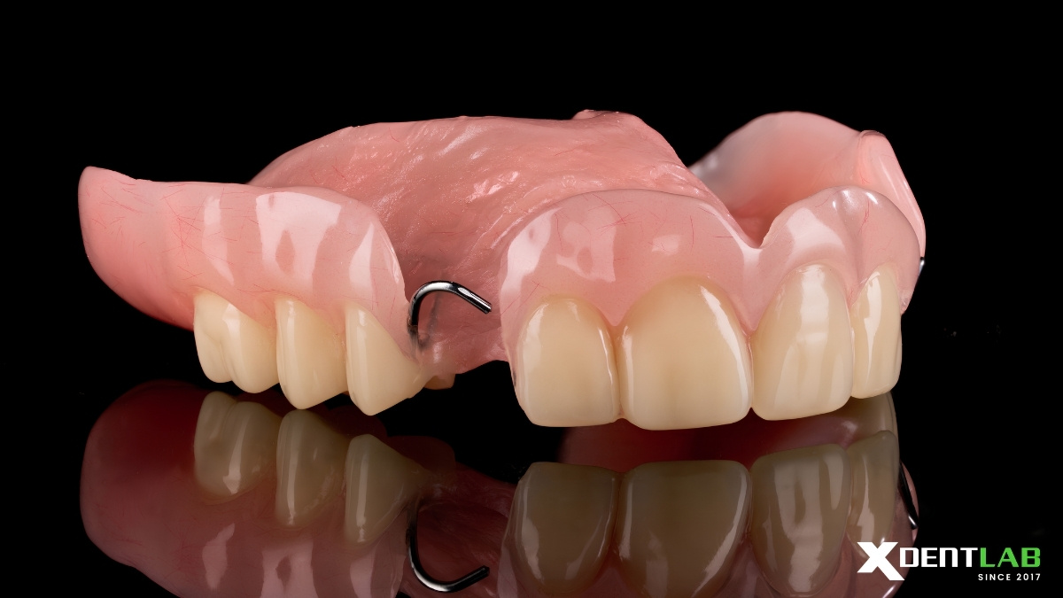 Case Acrylic Maxillary Partial Denture Case Acrylic Maxillary Partial Denture