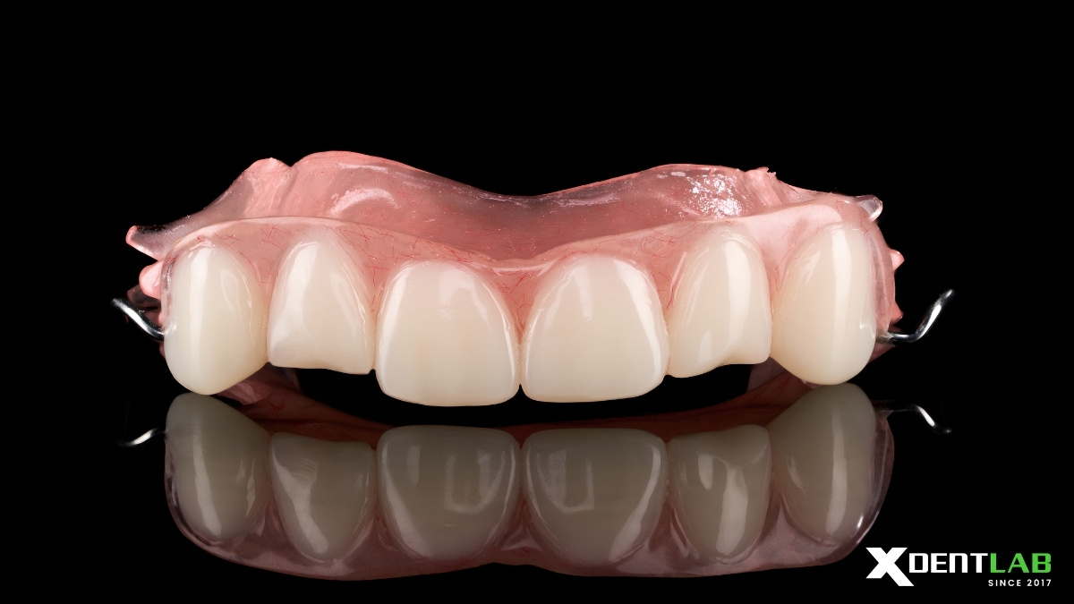 Acrylic partial denture case with custom tooth form Acrylic partial denture case with custom tooth form