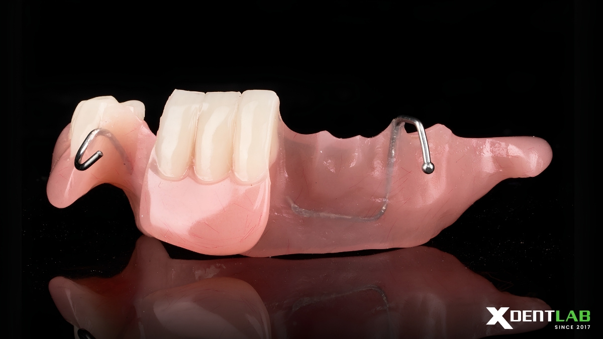 Case Acrylic Mandibular Partial Denture Case Acrylic Mandibular Partial Denture