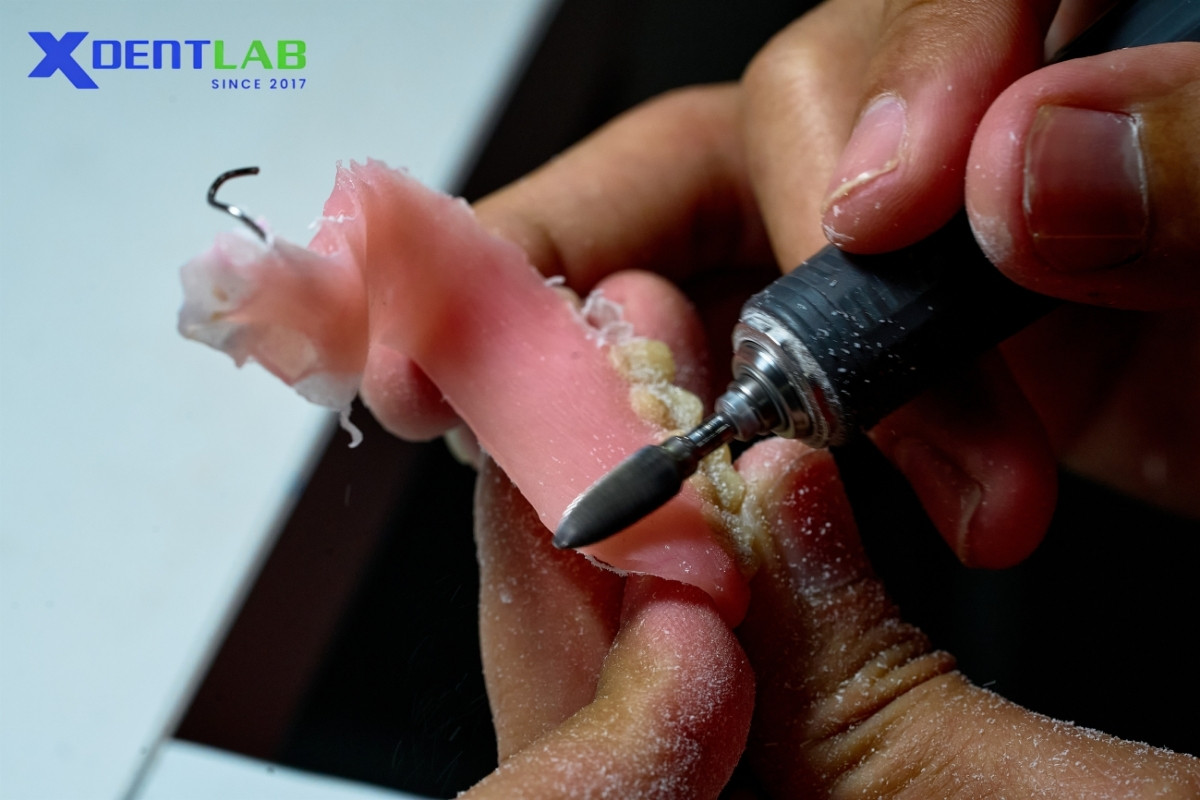 Why Dental Lab partner Choose XDENT LAB as subcontract service Why Dental Lab partner Choose XDENT LAB as subcontract service