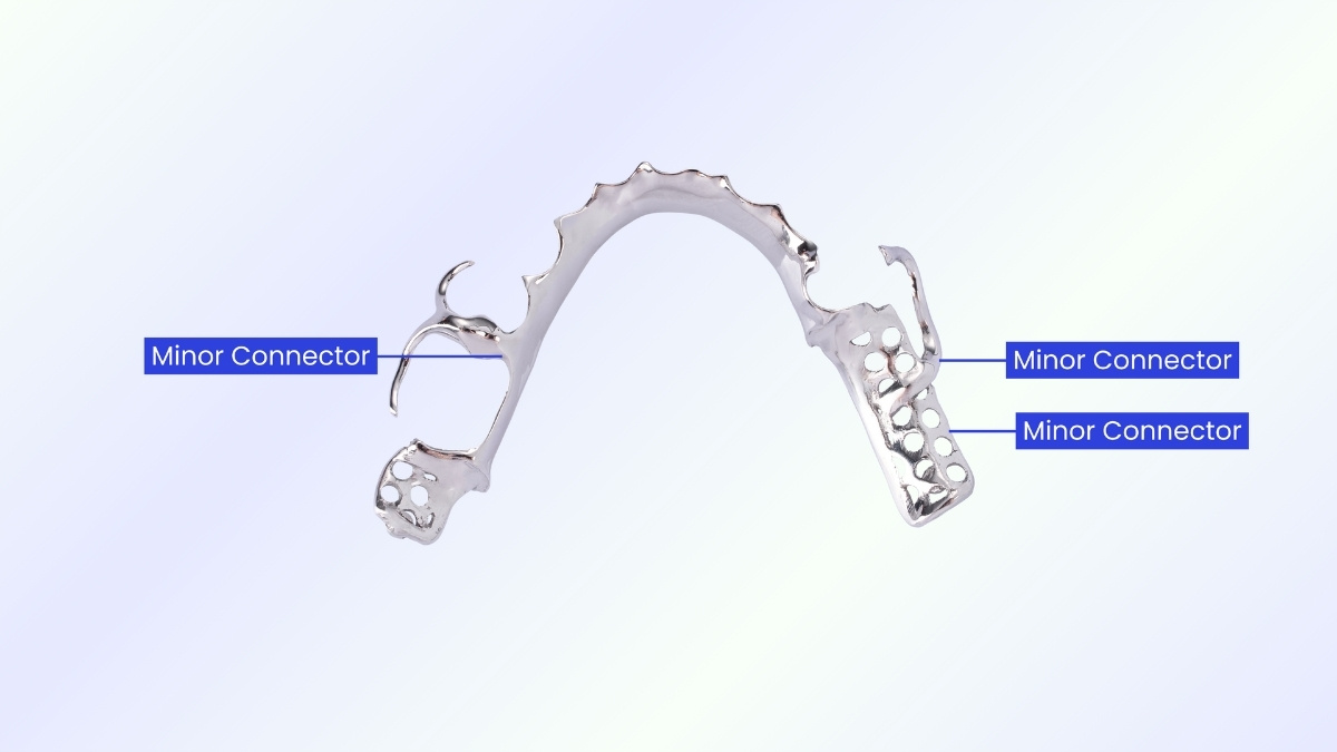 What Is a Minor Connector? What Is a Minor Connector?