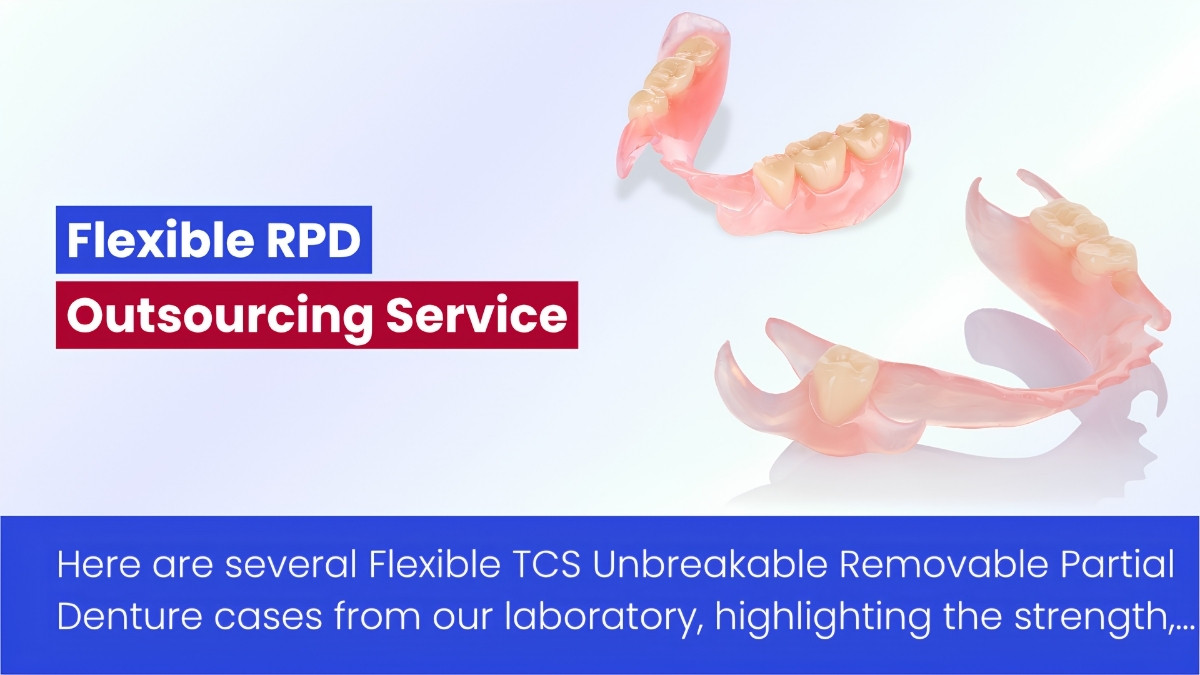 Flexible Removable Partial Denture Photos By Vietnam Dental Laboratory