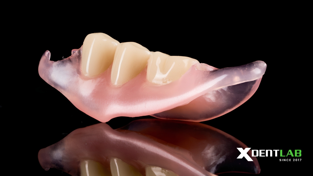 Case 2: Unilateral Denture Case Case 2: Unilateral Denture Case