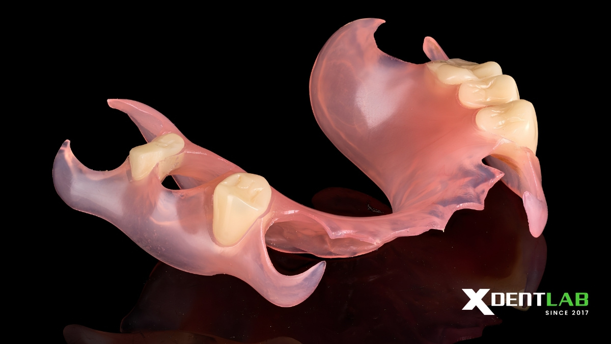 Case 3: Partial Denture Case Case 3: Partial Denture Case