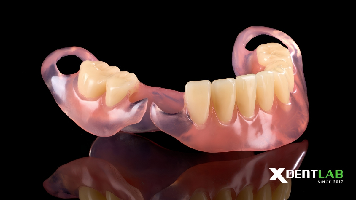 Case 4: Partial Denture Case Case 4: Partial Denture Case