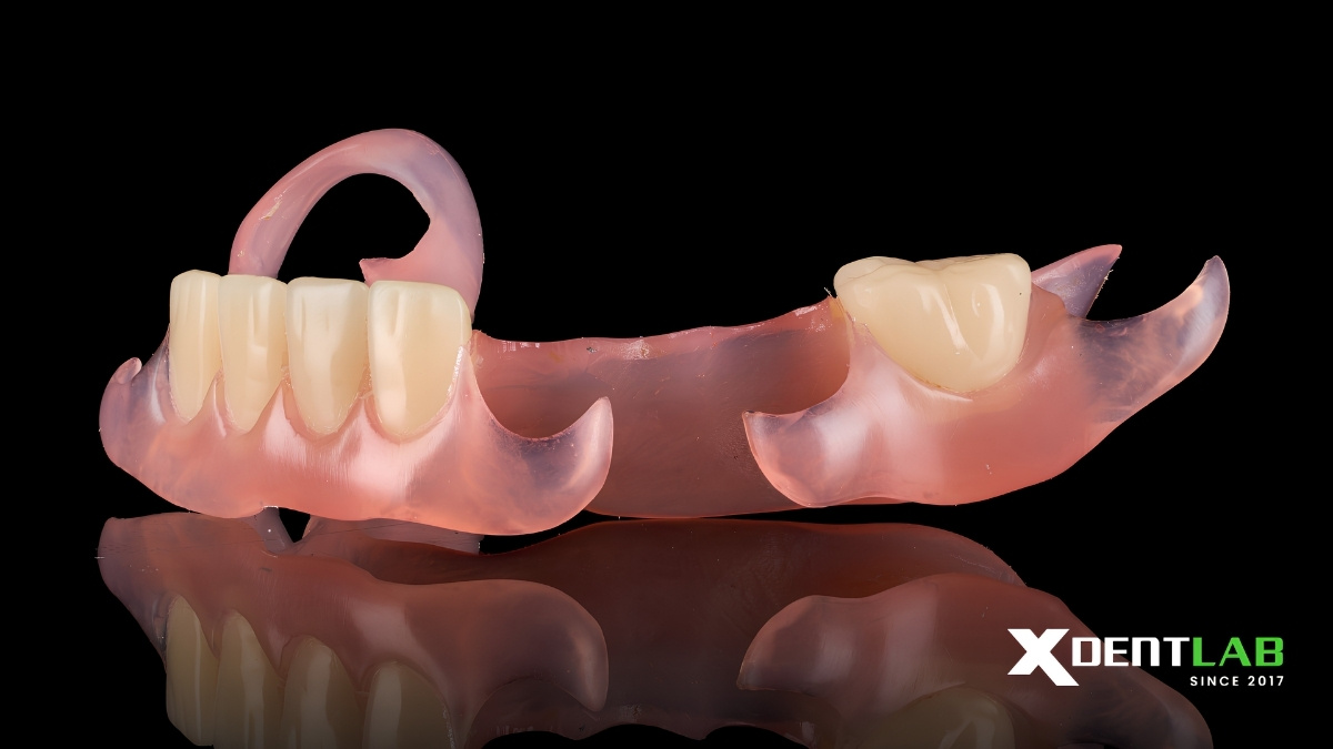 Case 5: Partial Denture Case Case 5: Partial Denture Case