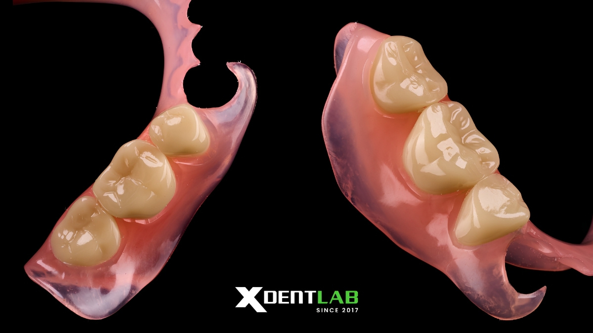 Why Dental Lab partner Choose XDENT LAB oversea outsourcing partner Why Dental Lab partner Choose XDENT LAB oversea outsourcing partner