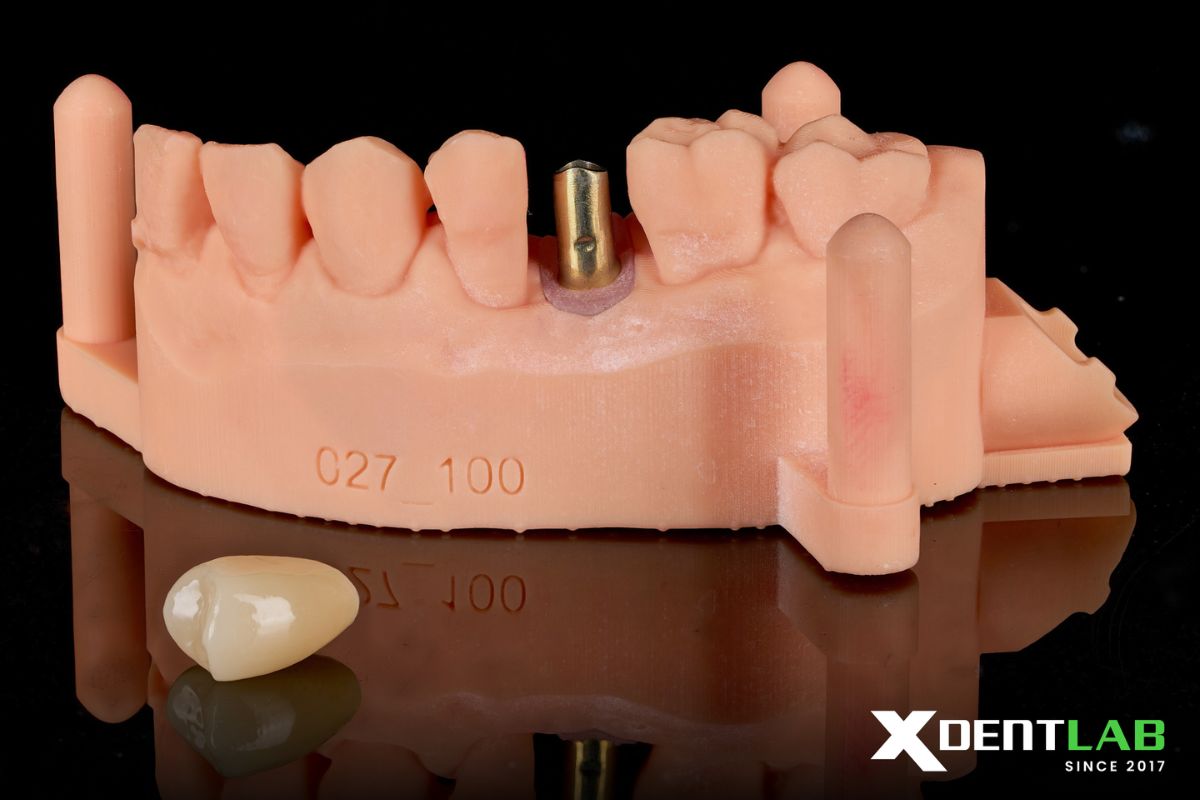 Precision Restorative Model