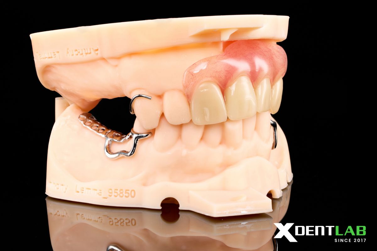 Dentures, RPD Frameworks, and Thermoforming Models