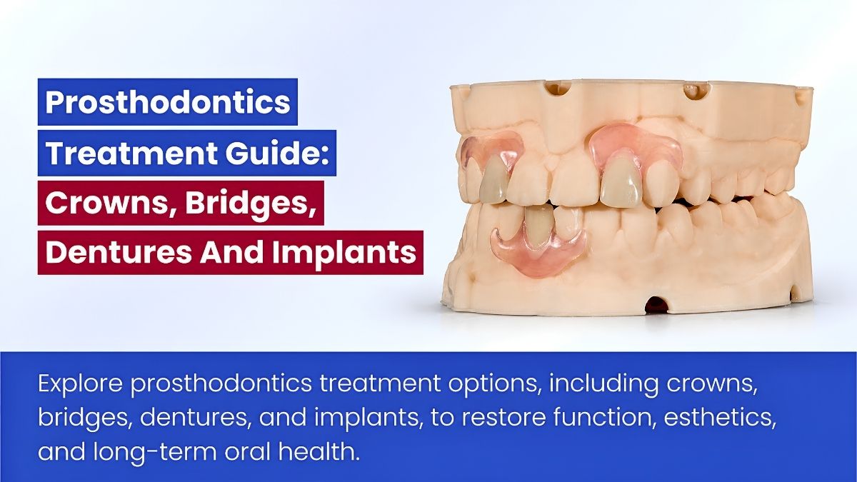 Prosthodontics In Dentistry: Types, Treatments And Benefits