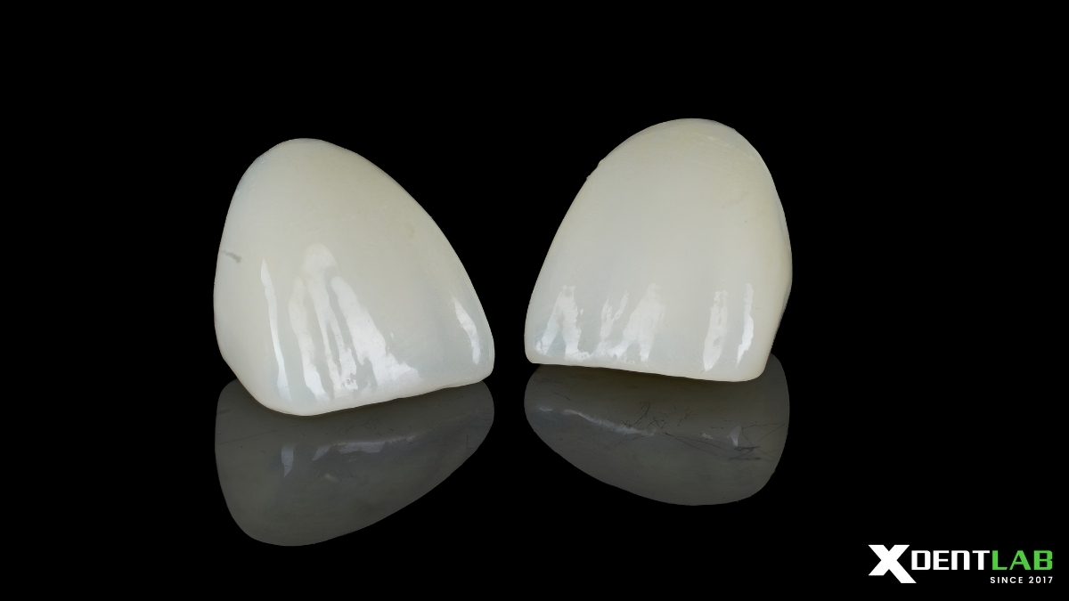 QA/QC Checklist In Zirconia Crown & Bridge Manufacturing QA/QC Checklist In Zirconia Crown & Bridge Manufacturing