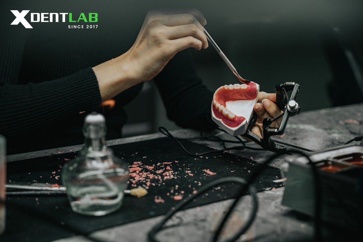 Traditional Dental Lab Industry Traditional Dental Lab Industry