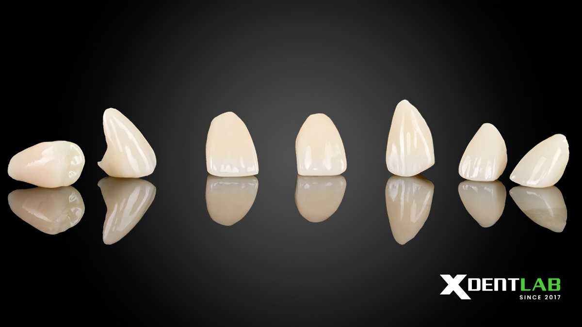 Zirconia Crown Case By Vietnam Dental Lab – Outsourcing Service Zirconia Crown Case By Vietnam Dental Lab – Outsourcing Service