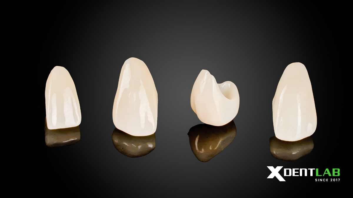Zirconia Crown Case By Vietnam Dental Lab – Outsourcing Service Zirconia Crown Case By Vietnam Dental Lab – Outsourcing Service