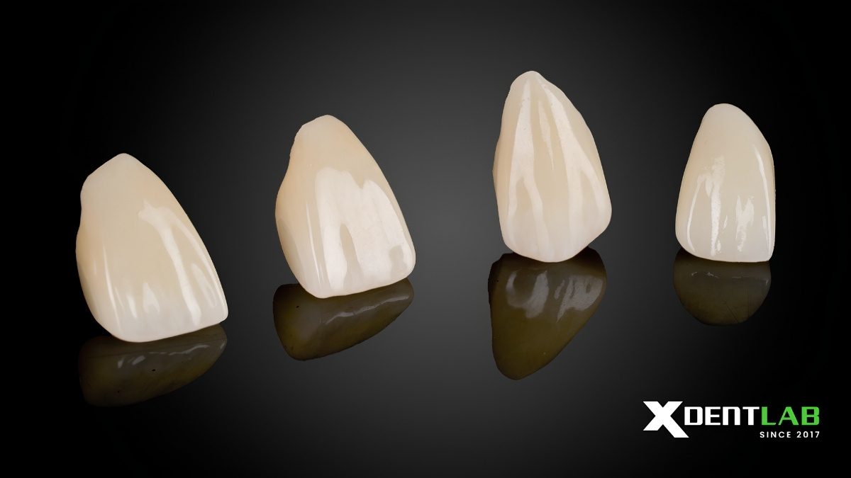 Zirconia Crown Case By Vietnam Dental Lab – Outsourcing Service Zirconia Crown Case By Vietnam Dental Lab – Outsourcing Service