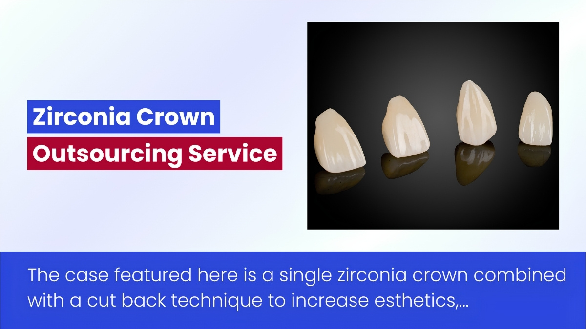 Zirconia Crown Case By Vietnam Dental Lab – Outsourcing Service