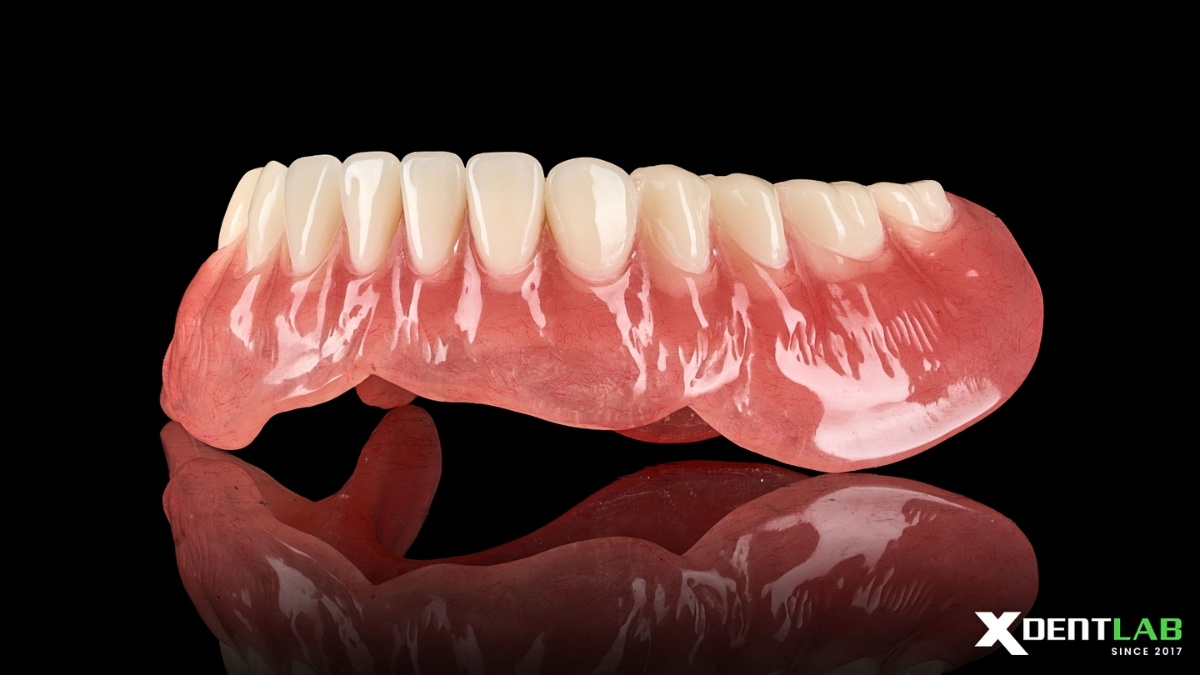 Case 1: Mandibular Complete Denture Case Case 1: Mandibular Complete Denture Case
