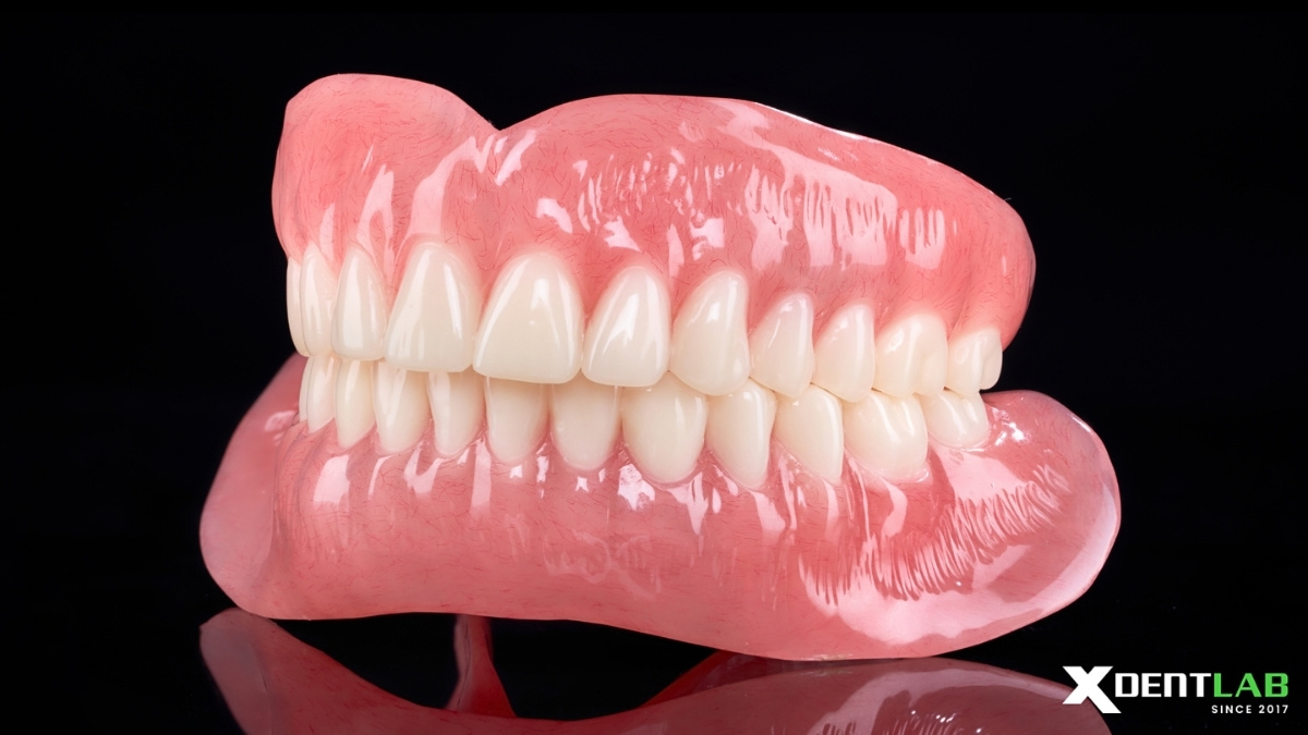 Case 4: Complete Denture Case Case 4: Complete Denture Case