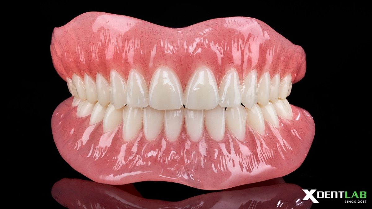 Case 5: Complete Denture Case Case 5: Complete Denture Case