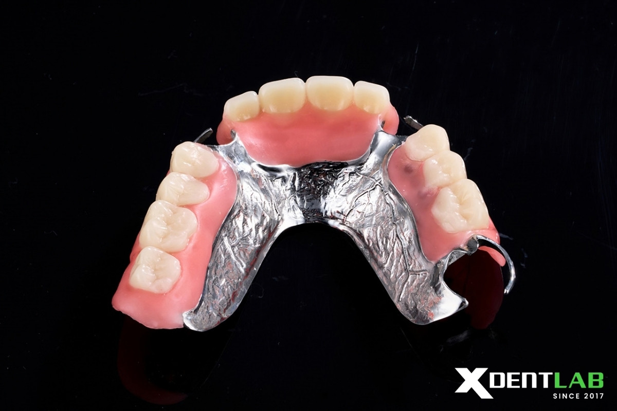 Why this matters for XDENT LAB Why this matters for XDENT LAB
