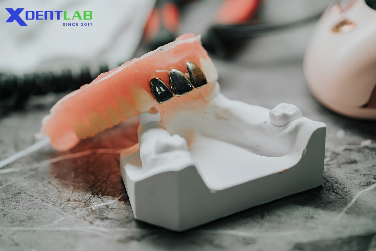 Why crowns matter in dental lab outsourcing Why crowns matter in dental lab outsourcing