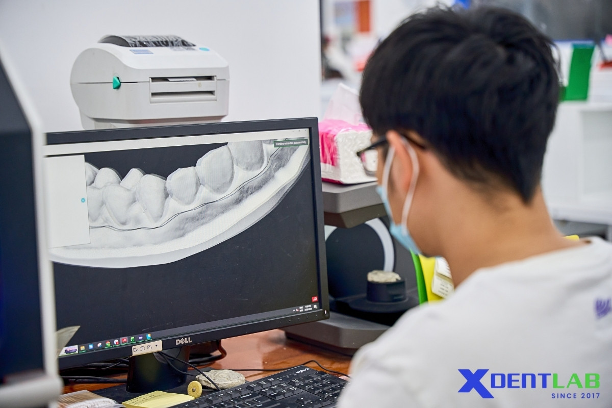 Best practices for dental labs using subcontractors Best practices for dental labs using subcontractors