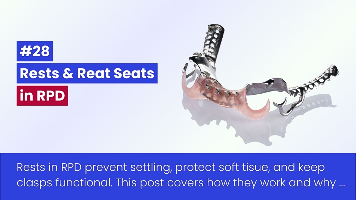Rests And Rest Seats In Removable Partial Dentures