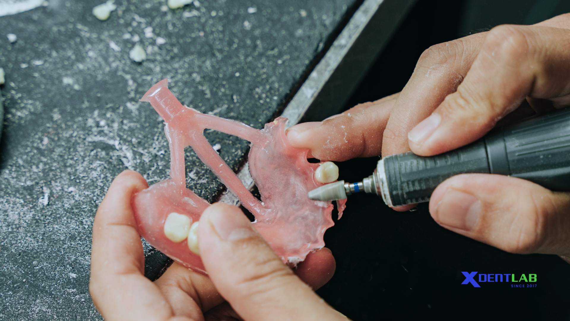 nhựa acrylic trong nha khoa_3